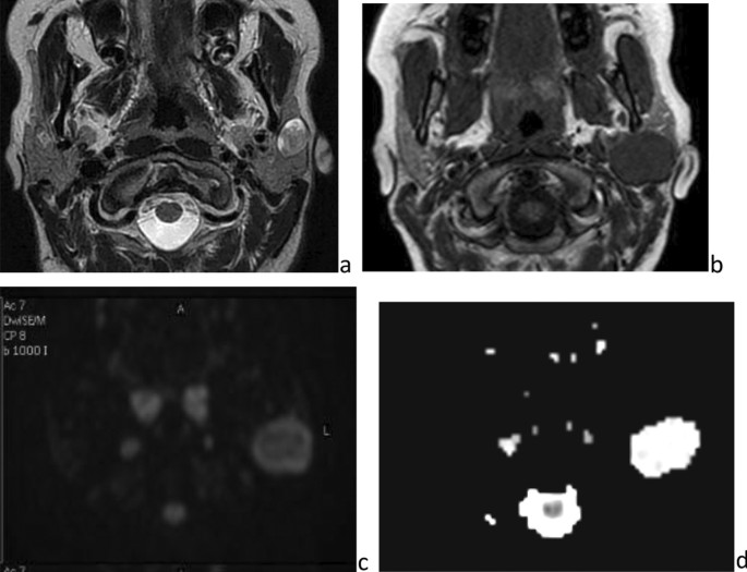 figure 14