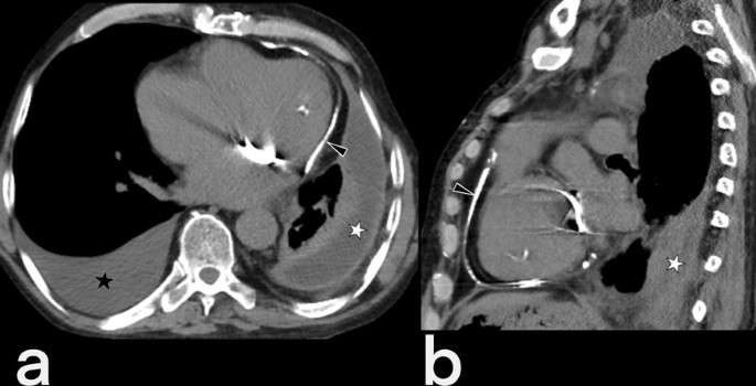 figure 19