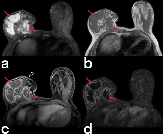 figure 22