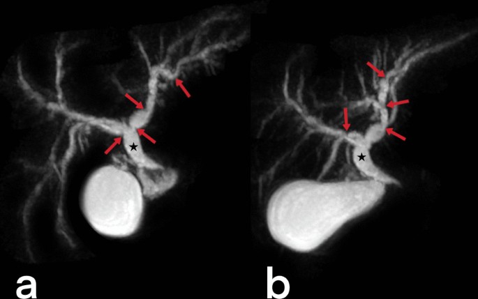 figure 31