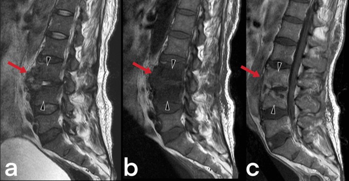 figure 45