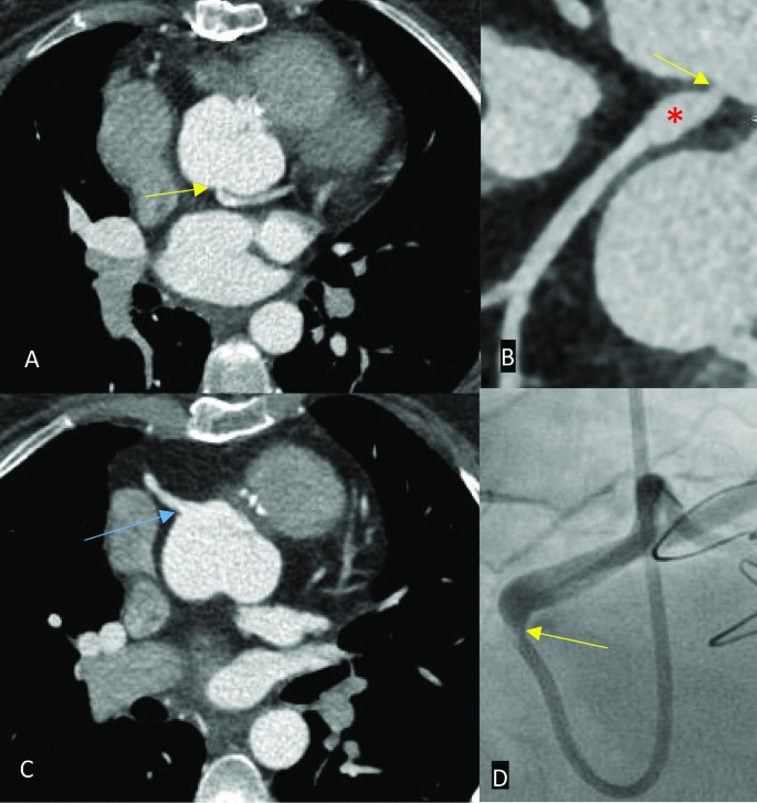 figure 21