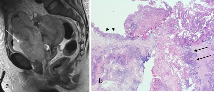 figure 18