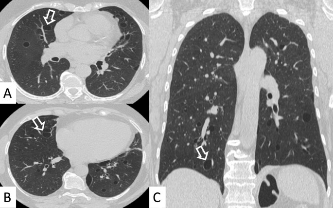 figure 26