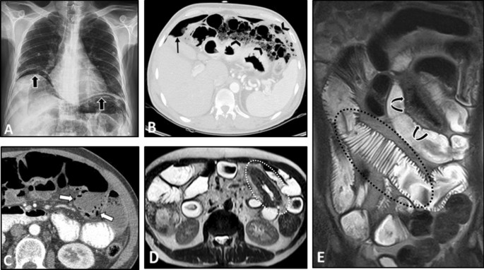 figure 18