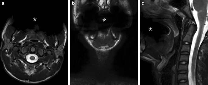 figure 26