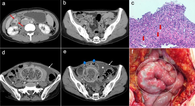 figure 14