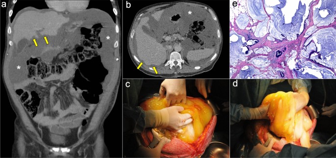 figure 17