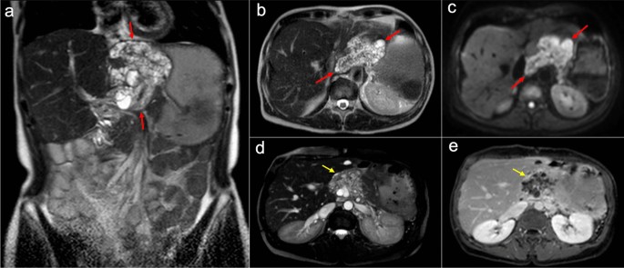 figure 21