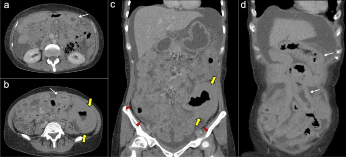 figure 25