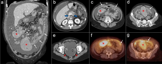 figure 26