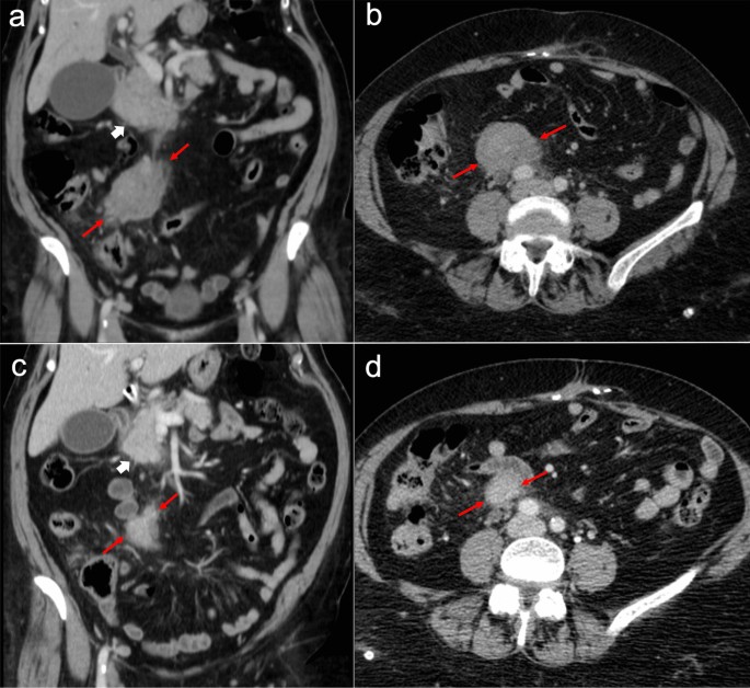 figure 32