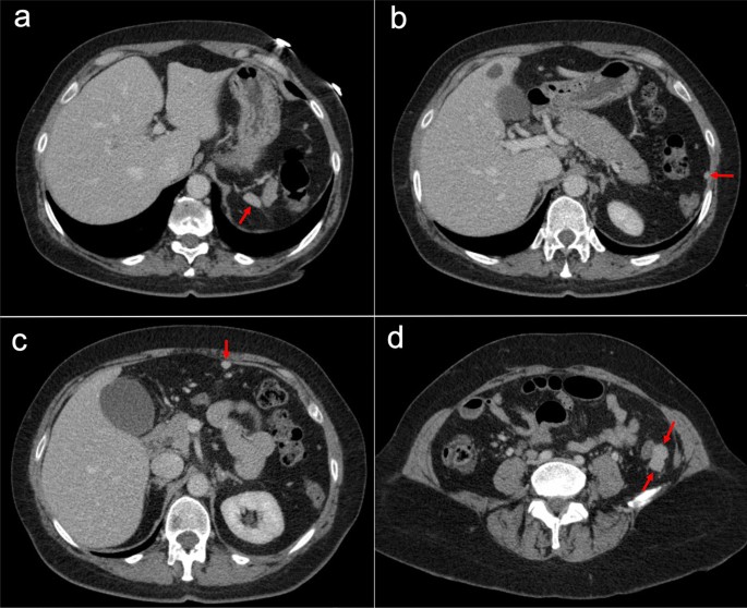 figure 34