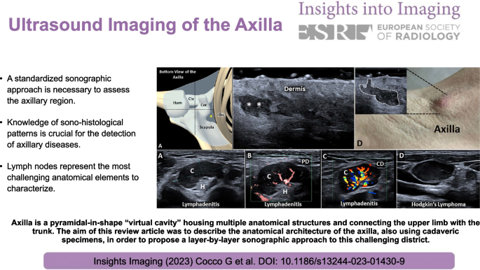 Ultrasound imaging of the axilla, Insights into Imaging
