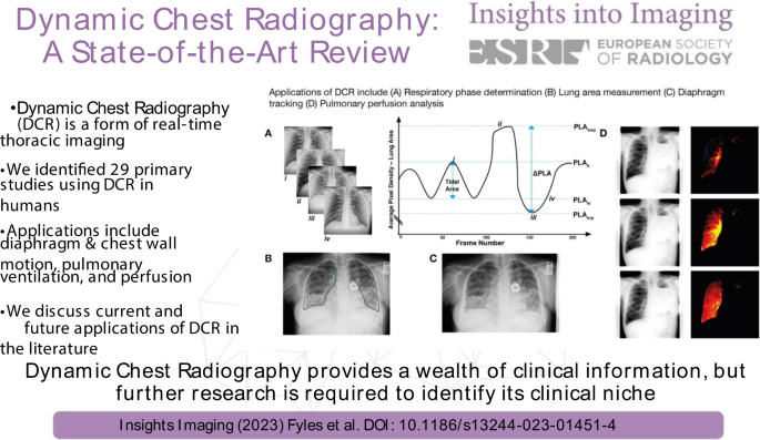 literature review chest radiography