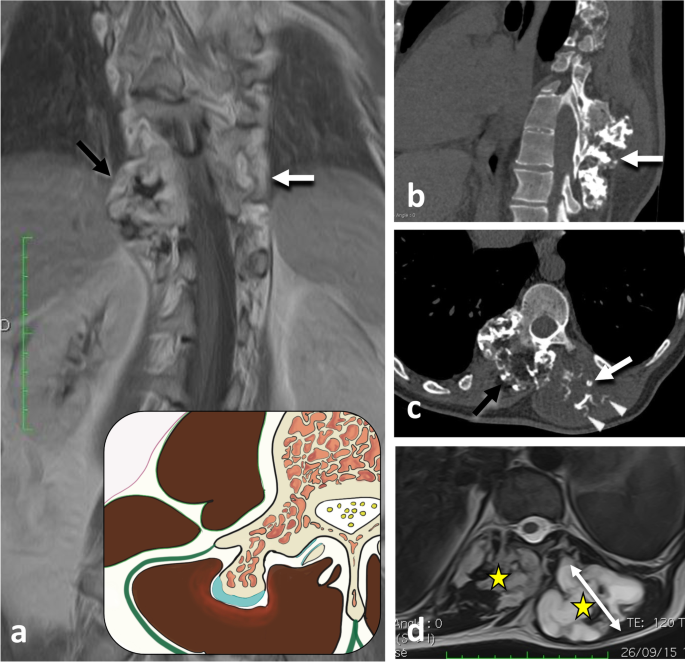 figure 29