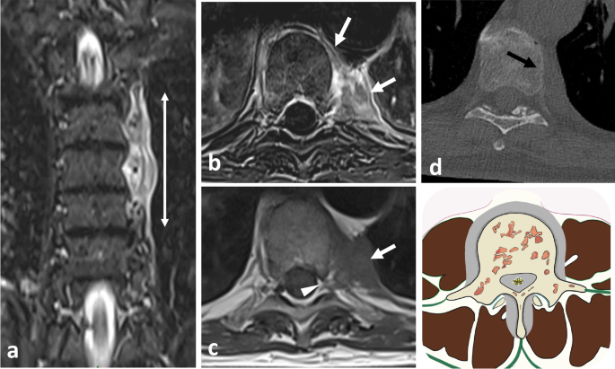 figure 31