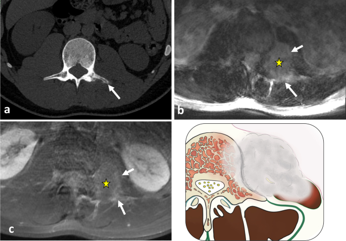 figure 32