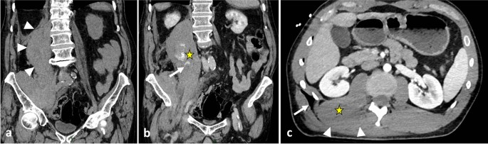 figure 33