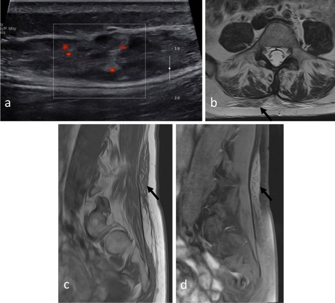 figure 34