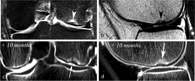 figure 23