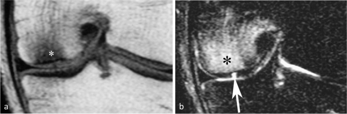 figure 27