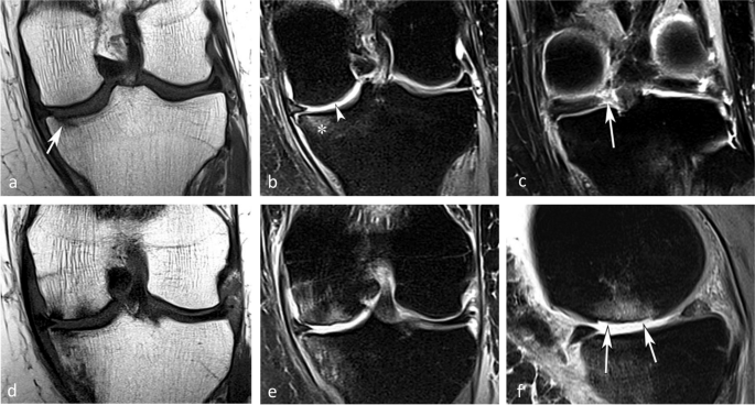 figure 29