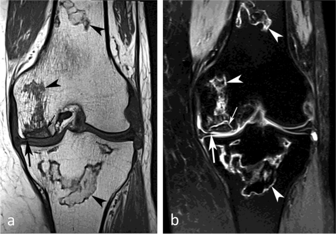 figure 32