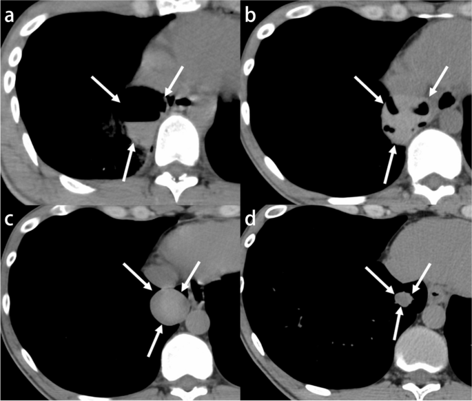 figure 18