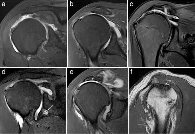 figure 24