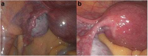 figure1