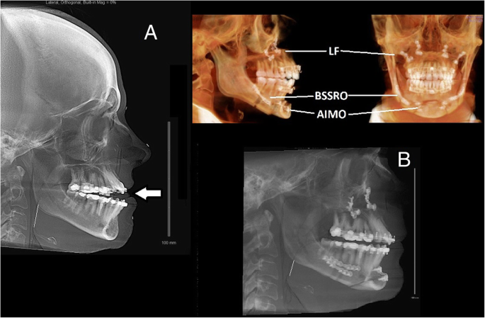  figure3