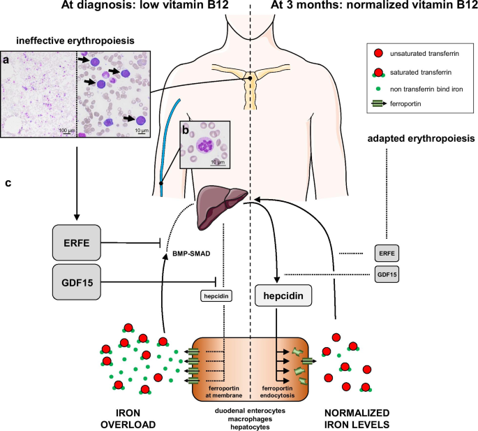 case study megaloblastic anemia figure 1