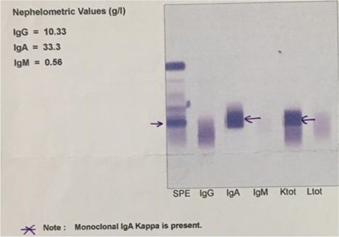 Extramedullary relapse of Immunoglobulin A-kappa myeloma manifesting as plasmacytoma of the pleura without bone marrow involvement and following autologous bone marrow transplant: a case report | Journal Medical Case Reports