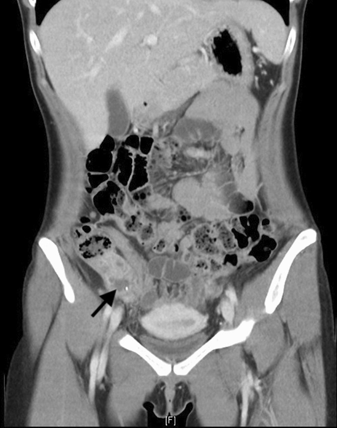 journal article presentation figure 1