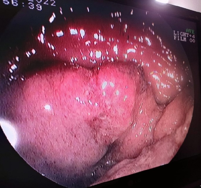figura 3