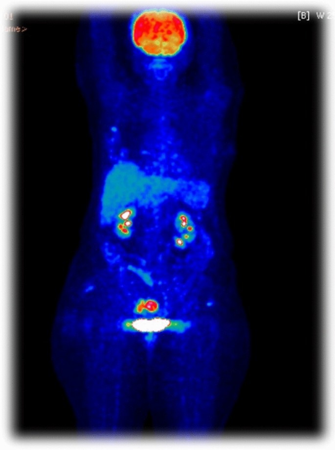 figura 4