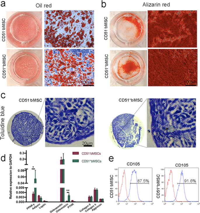 Cd51 Distinguishes A Subpopulation Of Bone Marrow Mesenchymal Stem Cells With Distinct Migratory Potential A Novel Cell Based Strategy To Treat Acute Myocardial Infarction In Mice Stem Cell Research Therapy