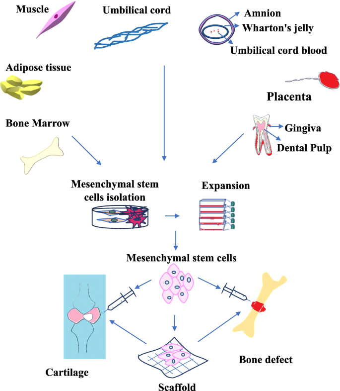 Stem Cell Therapy  Cellular Injections for Chronic Joint Pain