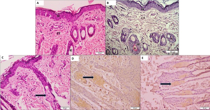 Label the photomicrograph of thin skin.