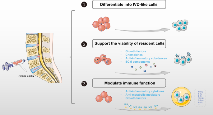 Application Of Stem Cells In The Repair Of Intervertebral Disc Degeneration  | Stem Cell Research &amp; Therapy | Full Text