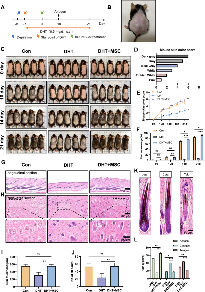Restoration of follicular -catenin signaling by mesenchymal stem cells promotes hair growth in mice with androgenetic alopecia | Stem Cell Research & Therapy | Springer Nature Link Restoration of follicular -catenin signaling by mesenchymal stem cells promotes hair growth in mice with androgenetic alopecia | Stem Cell Research & Therapy | Springer Nature Link