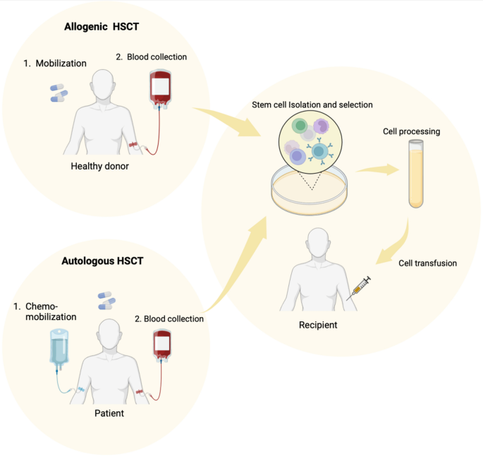 Understanding Autologous Transplantation
