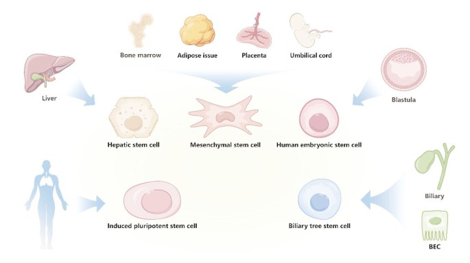 Mesenchymal stem cell therapy for end-stage liver disease: adversity ...