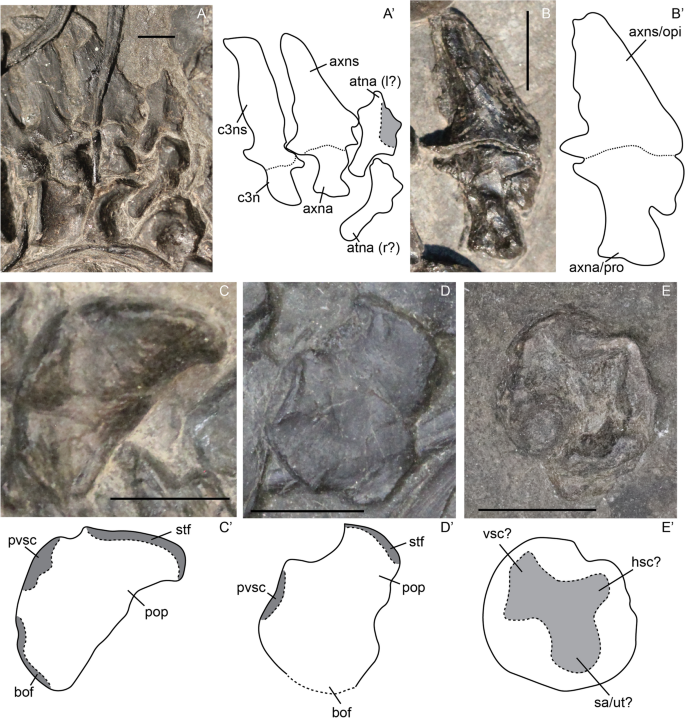 Illustration of stapes morphology following the nomenclature of