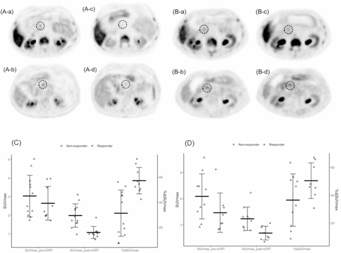 Predicting pathological response to neoadjuvant chemoradiotherapy in ...