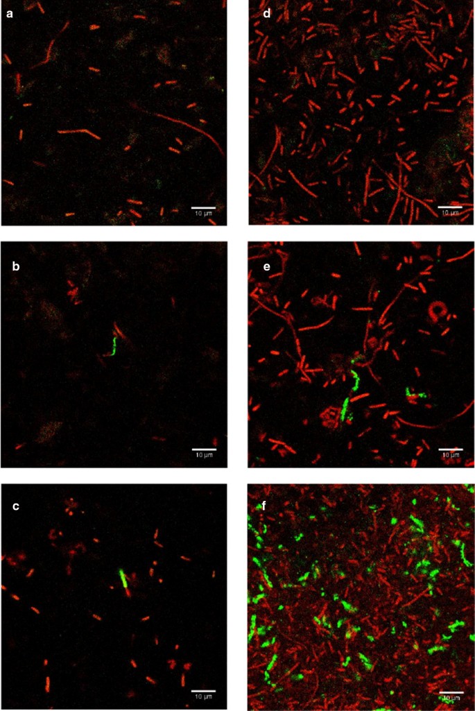 Rapid Detection Of Escherichia Coli In Beverages Using Genetically Engineered Bacteriophage T7 Amb Express Full Text Rapid Detection Of Escherichia Coli In Beverages Using Genetically Engineered Bacteriophage T7 Amb Express Full Text