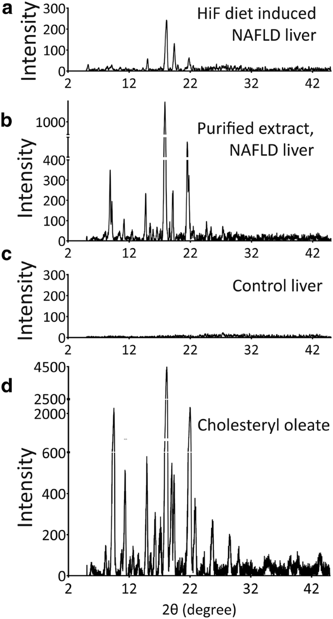Nonalcoholic Fatty Liver Disease Experiences Accumulation Of Hepatic Liquid Crystal Associated With Increasing Lipophagy Cell Bioscience Full Text Nonalcoholic Fatty Liver Disease Experiences Accumulation Of Hepatic Liquid Crystal Associated With Increasing Lipophagy Cell Bioscience Full Text