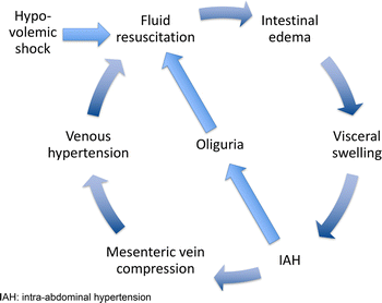 Principles of fluid management and stewardship in septic shock: it is time  to consider the four D's and the four phases of fluid therapy | Annals of  Intensive Care | Full Text