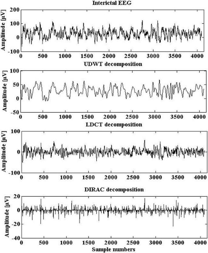 Epilepsy Eeg Classification Using Morphological Component Analysis Eurasip Journal On Advances In Signal Processing Full Text